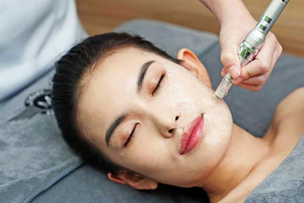 Best Acne Treatment In Delhi NCR