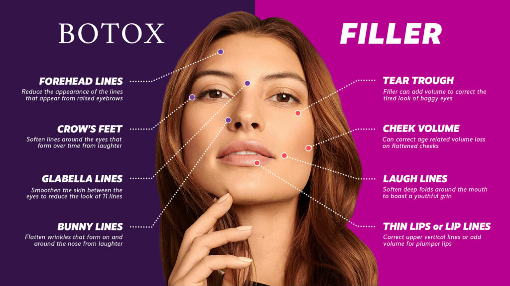 Best Injectables - Fillers Botox